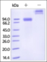 Human Recombinant Siglec6 (from HEK293 Cells)