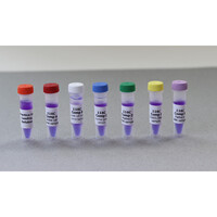 Sickle Cell Gene Detection (DNA-Based)