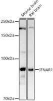 Anti-Interferon alpha / beta receptor 1 Rabbit Polyclonal Antibody