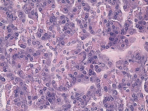 PANCREAS (SECT) H/E (HUMAN)