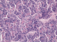 Pancreas, Human Slide