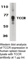 Anti-TCCR Rabbit Polyclonal Antibody