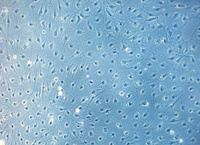 Human Dermal Lymphatic Endothelial Cells (HDLEC), PromoCell