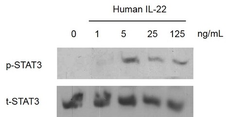 Human Recombinant IL-22 (from <i>E. coli</i>)