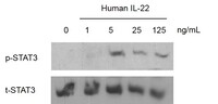 Human Recombinant IL-22 (from E. coli)