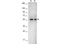 Anti-AKT1 Mouse Monoclonal Antibody [clone: 14E5.16C8.25F6]