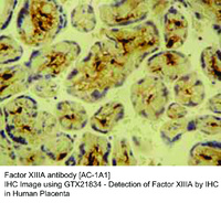 Anti-F13A1 Mouse Monoclonal Antibody [clone: AC-1A1]