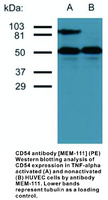 Anti-ICAM1 Mouse Monoclonal Antibody [clone: MEM-111]
