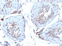 Anti-Sex Hormone Binding Globulin Mouse Monoclonal Antibody [clone: SHBG/245]
