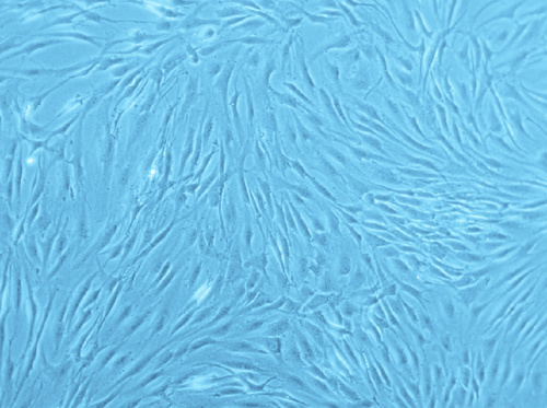 Primary Human Osteoblasts (HOB), PromoCell