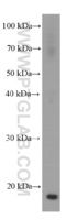 Anti-COTL1 Mouse Monoclonal Antibody [clone: 4A3D9]