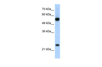 Anti-RPL13 Rabbit Polyclonal Antibody