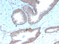 Anti-Sex Hormone Binding Globulin Mouse Recombinant Antibody [Clone: rSHBG-245]