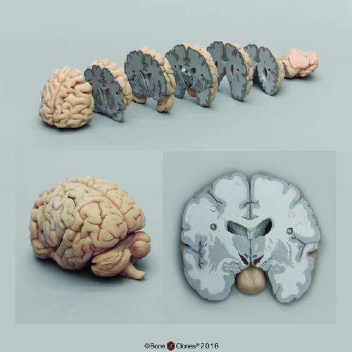 SECTIONED BRAIN