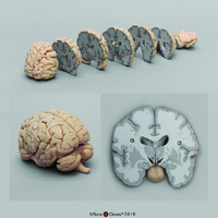 BoneClones® Sectioned Brain Model