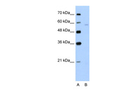 Anti-SLC22A7 Rabbit Polyclonal Antibody