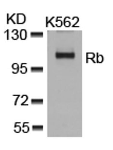 Rb (Ab 807) Antibody