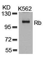 Anti-RB1 Rabbit Polyclonal Antibody