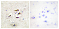 Anti-CaMK2 alpha + beta + delta Rabbit Polyclonal Antibody