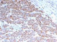 Anti-Cytokeratin 18 Mouse Recombinant Antibody [clone: rKRT18/1190]