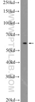 Anti-PSMC1 Rabbit Polyclonal Antibody