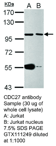 Rabbit Polyclonal antibody to CDC27 (cell division cycle 27 homolog (S. cerevisiae))