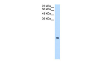 Anti-MRPS12 Rabbit Polyclonal Antibody