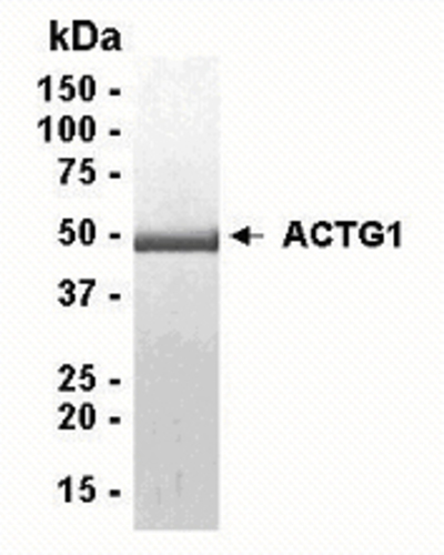 ACTG1 Recombinant Protein, Species: Human, Host: E. coli