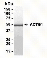 Human Recombinant ACTG1 (from E. coli)