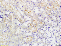 Anti-SLC16A3 Rabbit Polyclonal Antibody