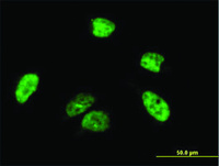 Anti-A1CF Mouse Polyclonal Antibody