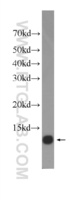 Anti-S100 A11 Mouse Monoclonal Antibody [clone: 1A3F1]