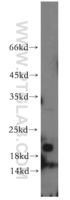 Anti-NBL1 Rabbit Polyclonal Antibody