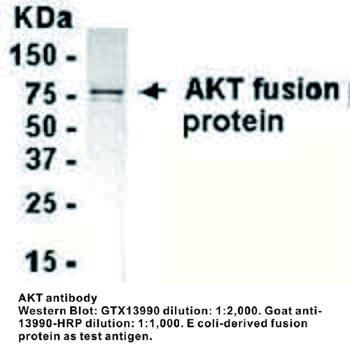 Chicken Polyclonal antibody to AKT (v-akt murine thymoma viral oncogene homolog 1)