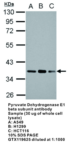 Rabbit Polyclonal antibody to Pyruvate Dehydrogenase E1 beta subunit