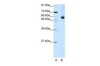 Anti-HNRNPL Rabbit Polyclonal Antibody