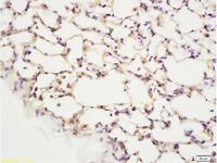 Anti-PTK2 Rabbit Polyclonal Antibody