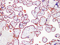 Anti-Placental Alkaline Phosphatase Mouse Monoclonal Antibody [clone: ABT-PLAP]