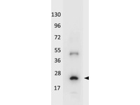 Anti-IL32 Rabbit Polyclonal Antibody (Biotin)