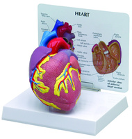 GPI Anatomicals® Basic Heart Model