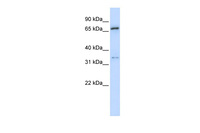 Anti-TRIM23 Rabbit Polyclonal Antibody