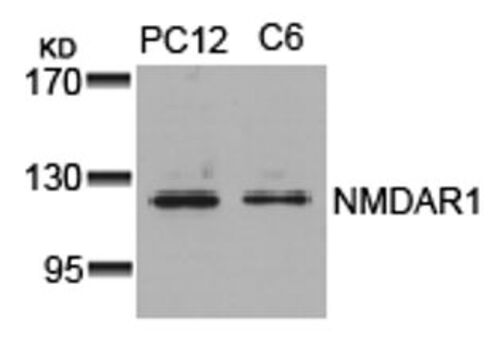 NMDAR1 (Ab 896) Antibody