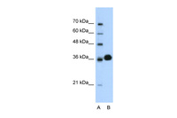 Anti-CDK6 Rabbit Polyclonal Antibody