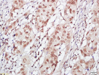 Anti-ZFPM1 Rabbit Polyclonal Antibody