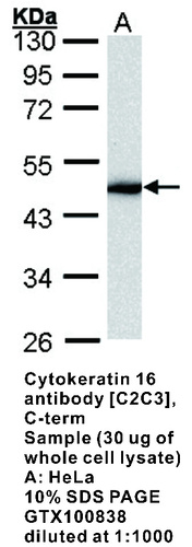Rabbit Polyclonal antibody to Cytokeratin 16 (keratin 16)