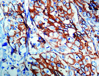 Anti-Epithelial Antigen Mouse Monoclonal Antibody [clone: Ber-EP4]