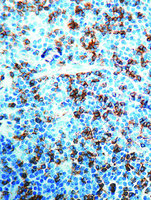 Anti-CD8 Rabbit Monoclonal Antibody [clone: SP16]
