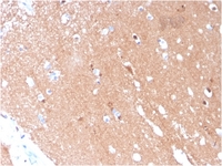 Anti-beta III Tubulin Mouse Monoclonal Antibody [clone: TUBB3/3731]