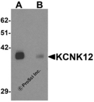 Anti-KCNK12 Rabbit Polyclonal Antibody
