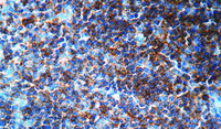 Anti-CD5 Rabbit Monoclonal Antibody [clone: SP19]